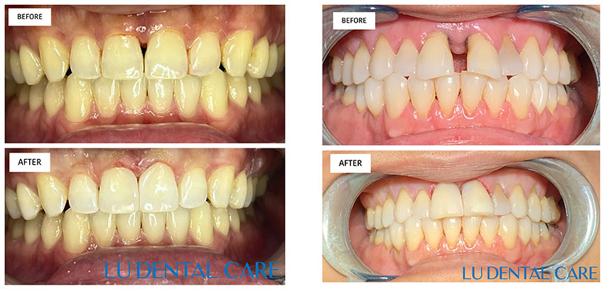 Bioclear in Alhambra