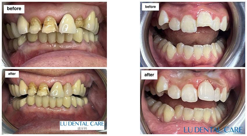 Bioclear in Alhambra